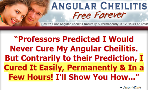 angular cheilitis free forever review